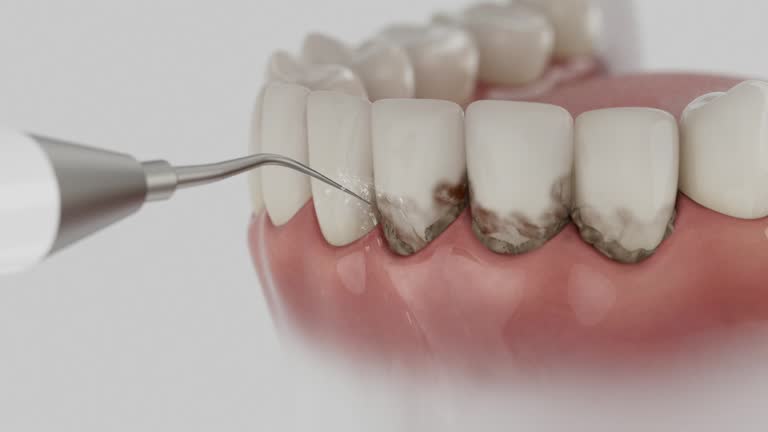 Trusted Emergency Dentist service in Jefferson City, MO - Dentist Open Now